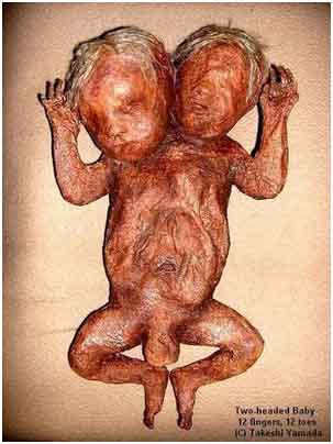 Mummi Bayi berwajah dua